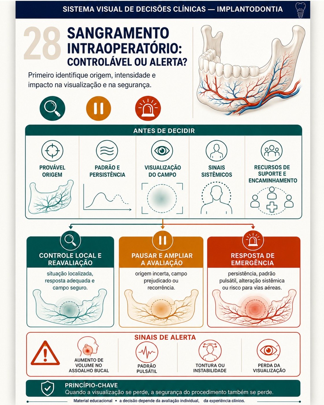 Painel visual de decisão clínica em Implantodontia