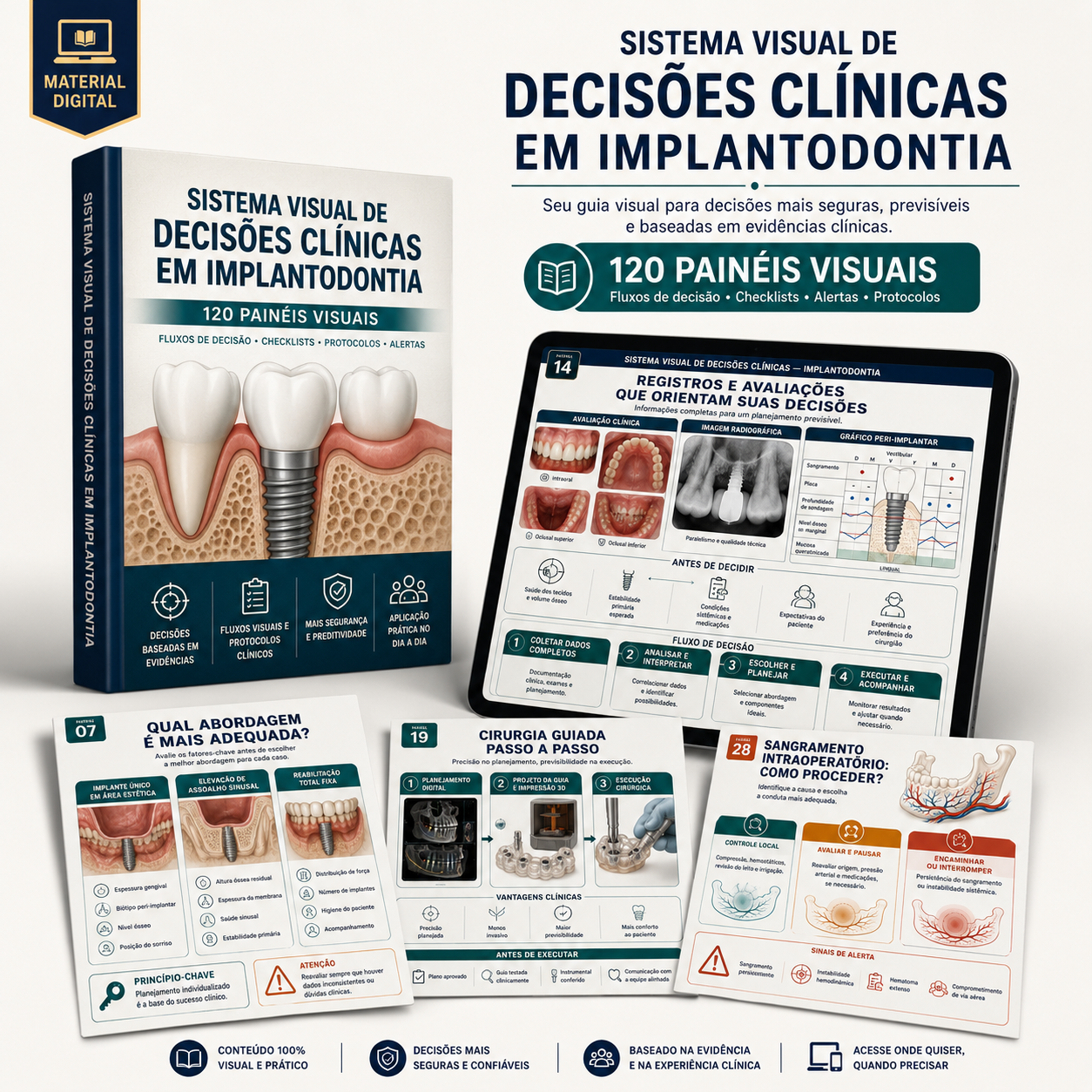 Mockup do Sistema Visual de Decisões Clínicas em Implantodontia